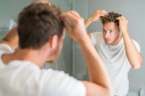 Debunking 9 Common Myths About Hair Loss in Men